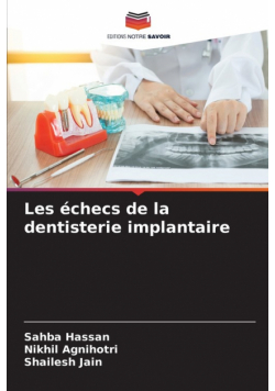 Les échecs de la dentisterie implantaire