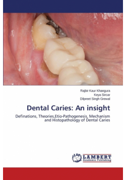 Dental Caries