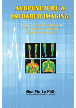 Acupuncture and Infrared Imaging