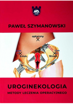 Uroginekologia Metody Leczenia Operacyjnego