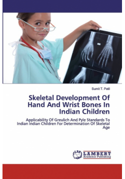 Skeletal Development Of Hand And Wrist Bones In Indian Children
