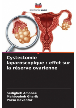 Cystectomie laparoscopique