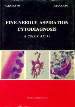 Fine-Needle Aspiration Cytodiagnosis: A Color Atlas