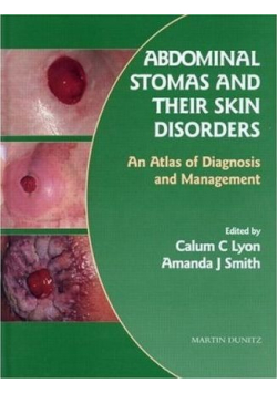 Abdominal stomas and their skin disorders