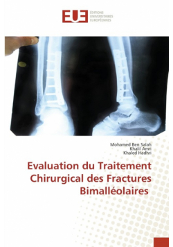 Evaluation du Traitement Chirurgical des Fractures Bimalléolaires
