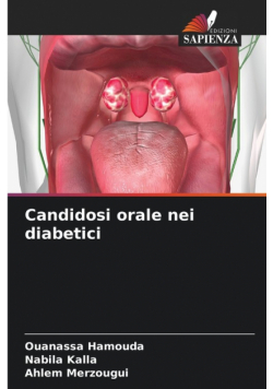 Candidosi orale nei diabetici