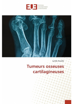 Tumeurs osseuses cartilagineuses