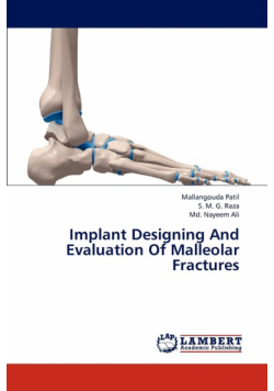 Implant Designing and Evaluation of Malleolar Fractures