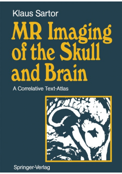 MR Imaging of the Skull and Brain A. Correlative Text-Atlas