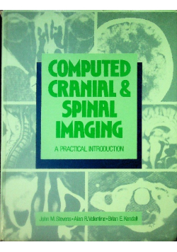 Computed Cranial And Spinal Imaging: A Practical Introduction