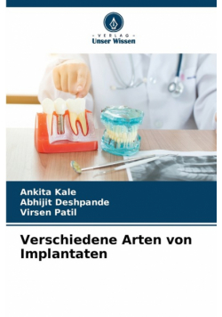 Verschiedene Arten von Implantaten