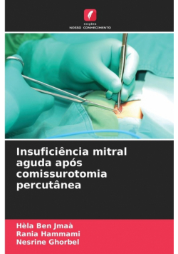 Insuficiência mitral aguda após comissurotomia percutânea