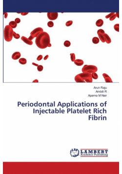 Periodontal Applications of Injectable Platelet Rich Fibrin