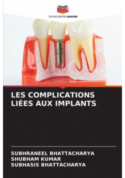 Les Complications Liées Aux Implants