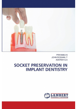 Socket Preservation In Implant Dentistry