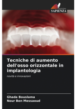 Tecniche di aumento dell'osso orizzontale in implantologia