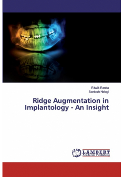 Ridge Augmentation in Implantology - An Insight