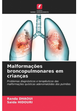 Malformações broncopulmonares em crianças