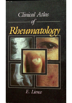 Clinical Atlas of Rheumatology