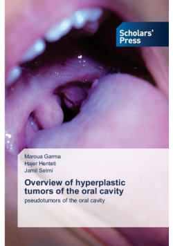 Overview of hyperplastic tumors of the oral cavity