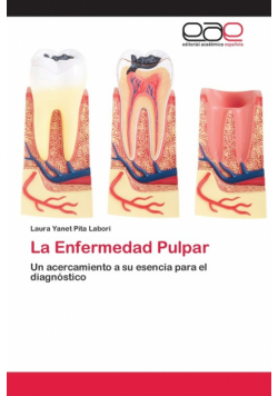 La Enfermedad Pulpar