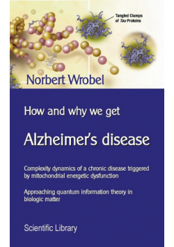 How and why we get Alzheimer's disease