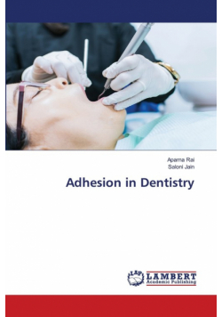 Adhesion in Dentistry