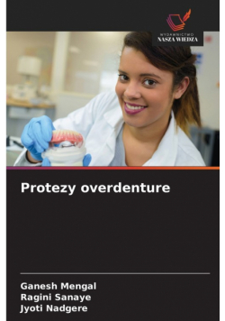 Protezy overdenture