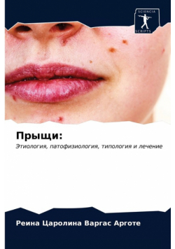Прыщи