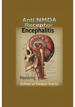 Mastering Anti NMDA Receptor Encephalitis
