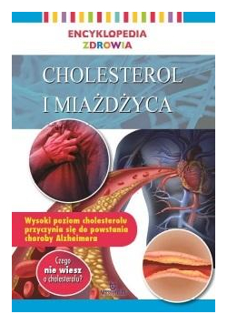 Encyklopedia zdrowia. Cholesterol i miażdżyca