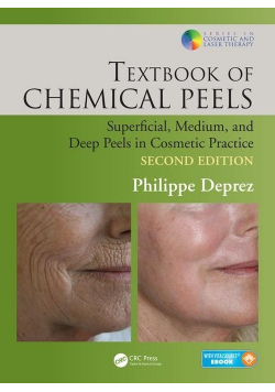 Textbook of Chemical Peels