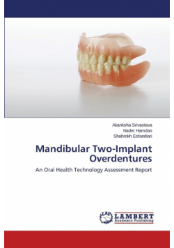 Mandibular Two-Implant Overdentures