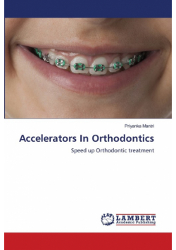 Accelerators In Orthodontics