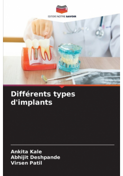 Différents types d'implants