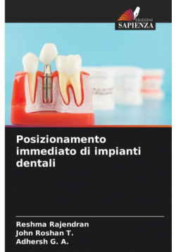Posizionamento immediato di impianti dentali