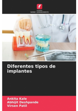 Diferentes tipos de implantes