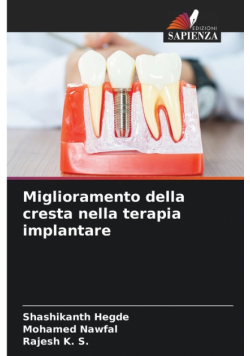 Miglioramento della cresta nella terapia implantare