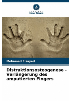 Distraktionsosteogenese - Verlängerung des amputierten Fingers