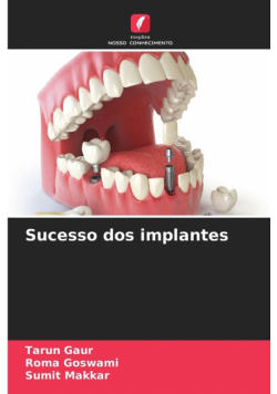 Sucesso dos implantes