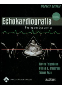 Echokardiografia Feigenbauma