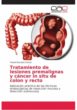 Tratamiento de lesiones premalignas y cáncer in situ de colon y recto