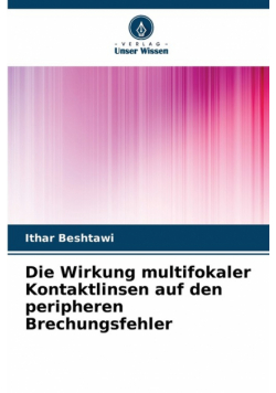 Die Wirkung multifokaler Kontaktlinsen auf den peripheren Brechungsfehler