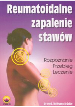 W. - Reumatoidalne zapalenie stawów