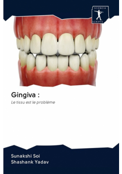 Gingiva