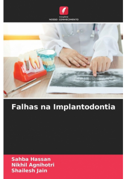 Falhas na Implantodontia