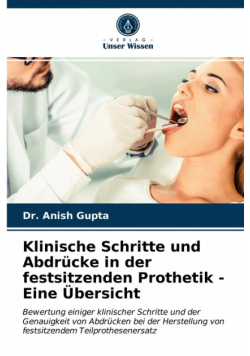 Klinische Schritte und Abdrücke in der festsitzenden Prothetik - Eine Übersicht