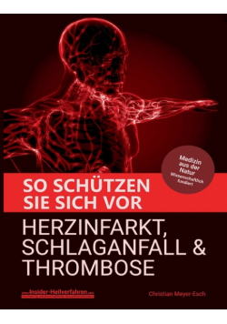 So schützen Sie sich vor Herzinfarkt, Schlaganfall und Thrombose