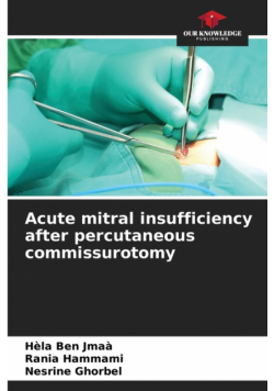 Acute mitral insufficiency after percutaneous commissurotomy