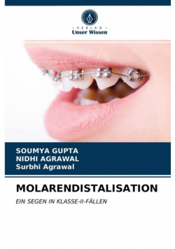 Molarendistalisation